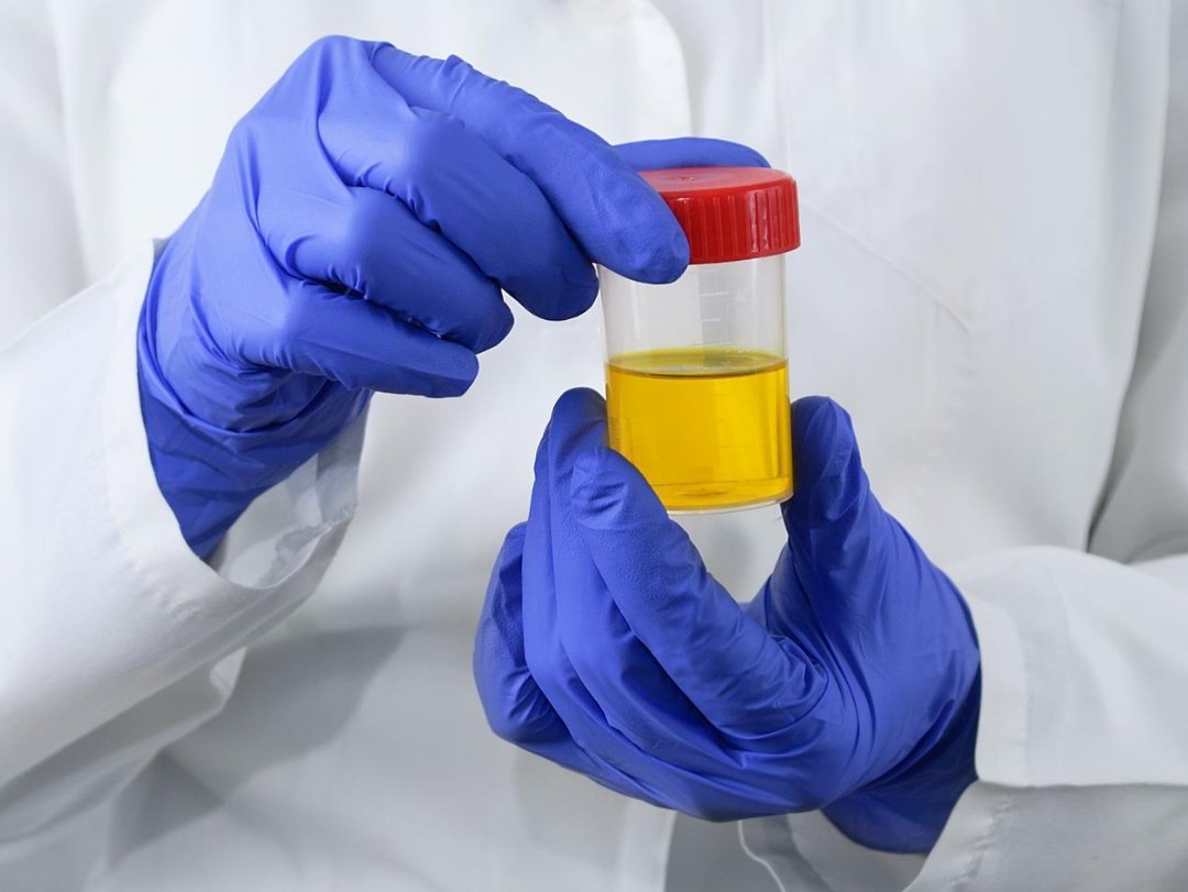 Gloved hands holding a urine sample container, relevant to DOT Testing Guidelines.